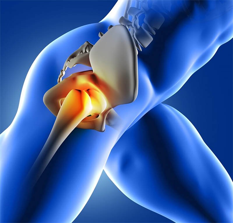 Steps of Anterior Hip Replacement Surgery