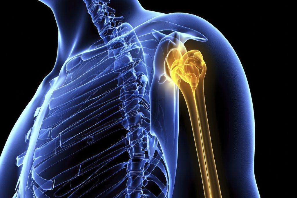 signs you need shoulder surgery