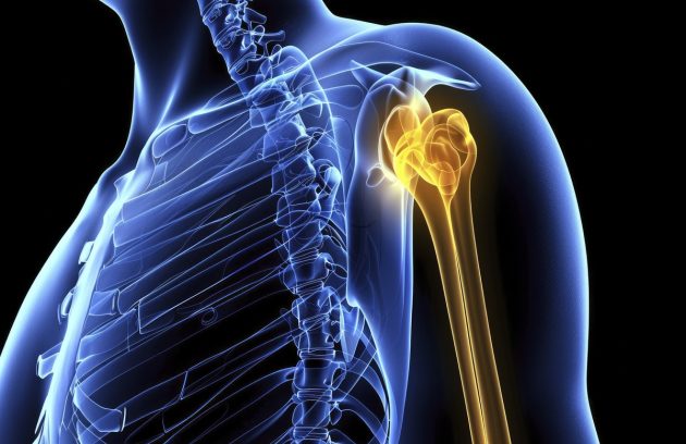 signs you need shoulder surgery