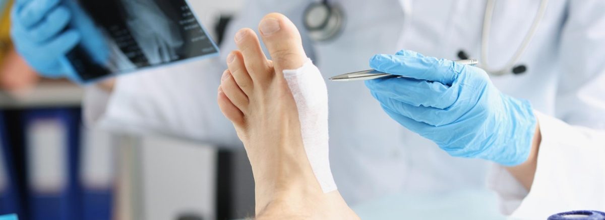 Effective Hammertoes Treatment and Surgery Options