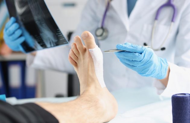 Effective Hammertoes Treatment and Surgery Options