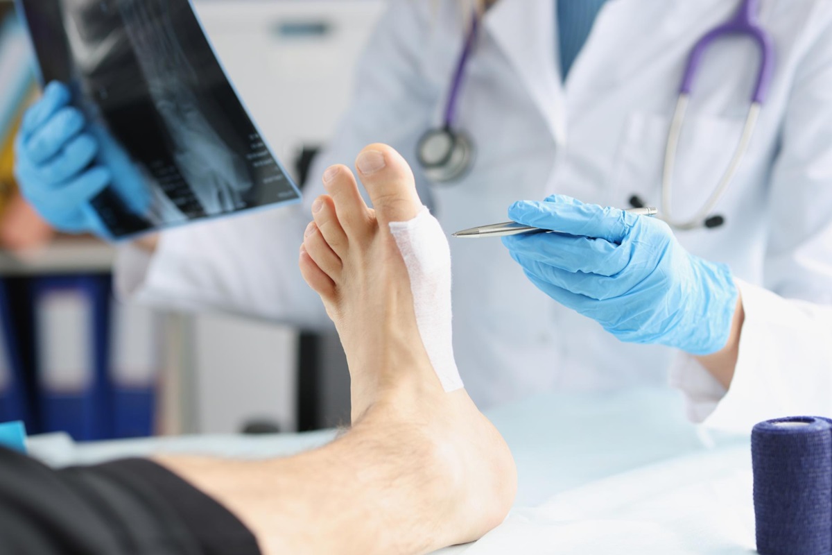 Effective Hammertoes Treatment and Surgery Options