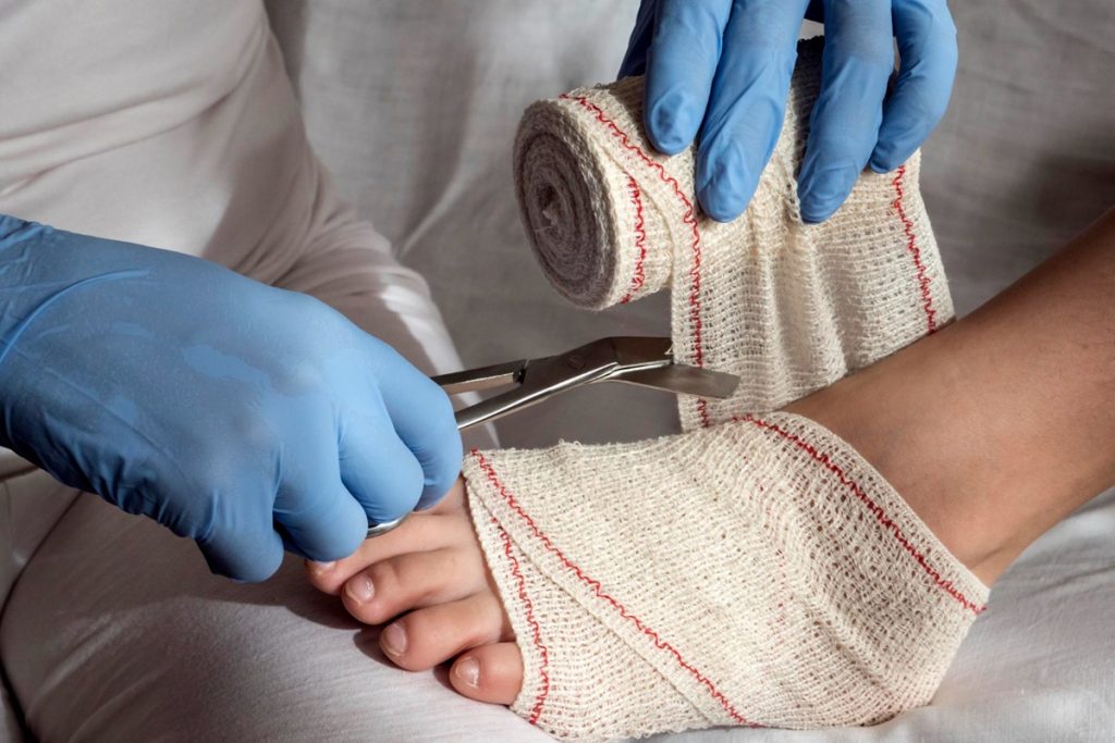 Foot Surgery Explained Types, Recovery & Risks