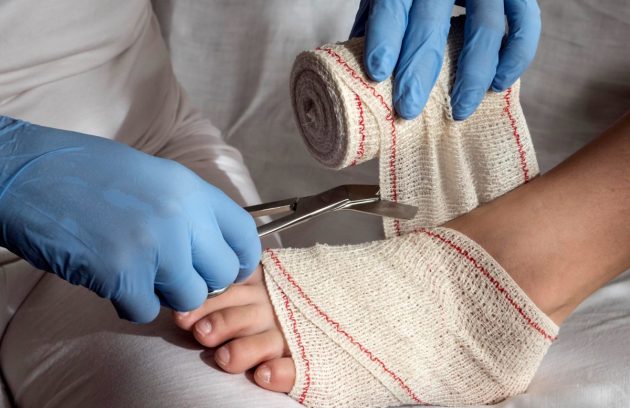 Foot Surgery Explained Types, Recovery & Risks