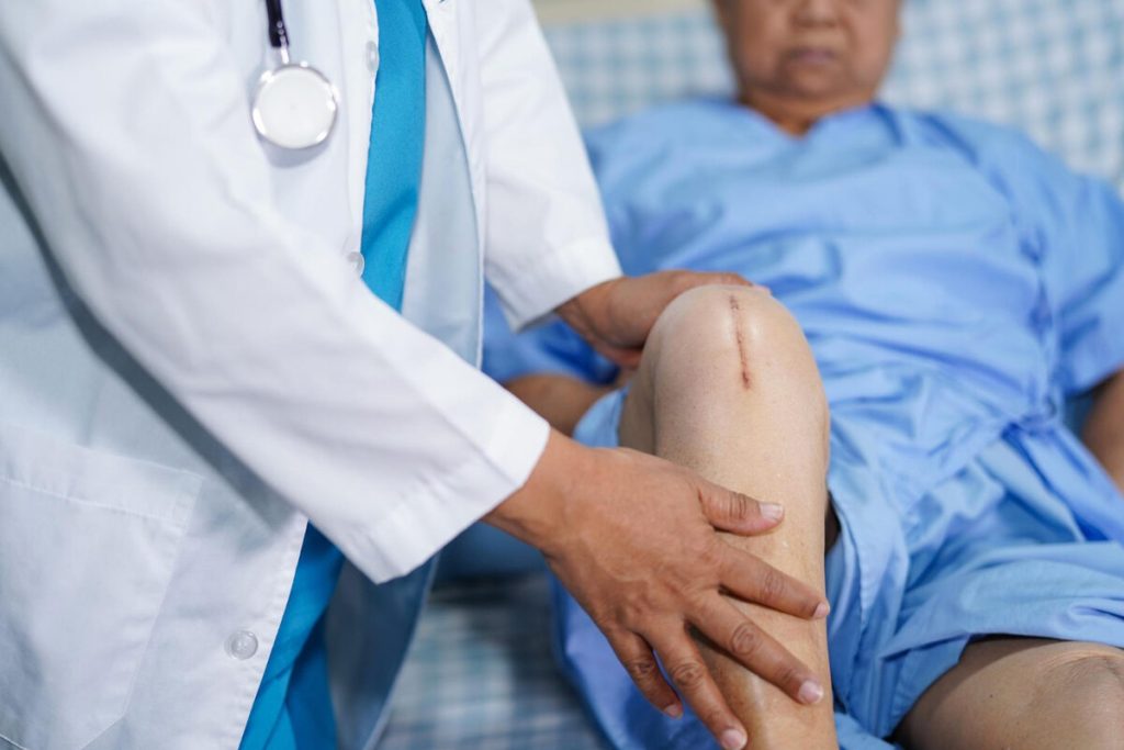 wait-times-for-knee-replacement-in-calgary